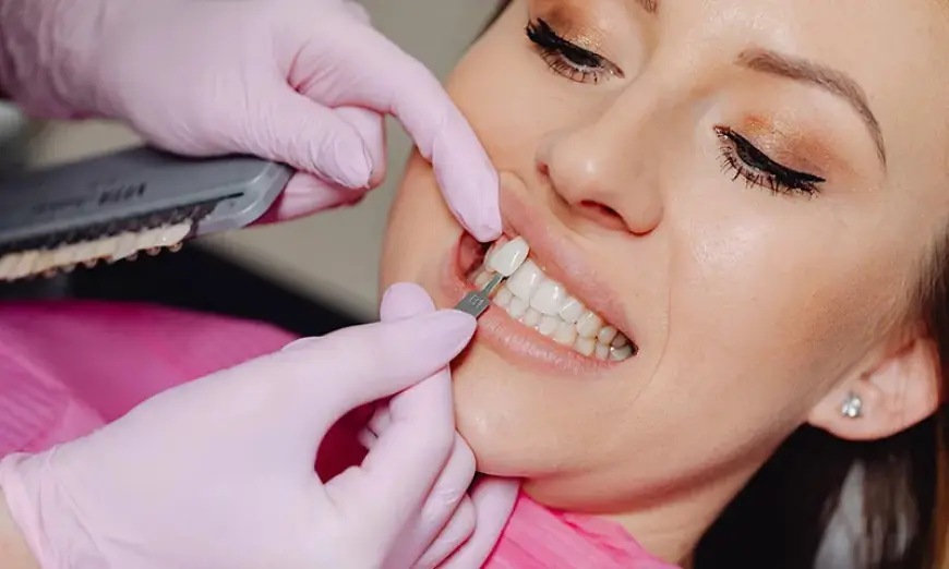 Expert Dentists for Dental Veneers in Islamabad – Trusted Care