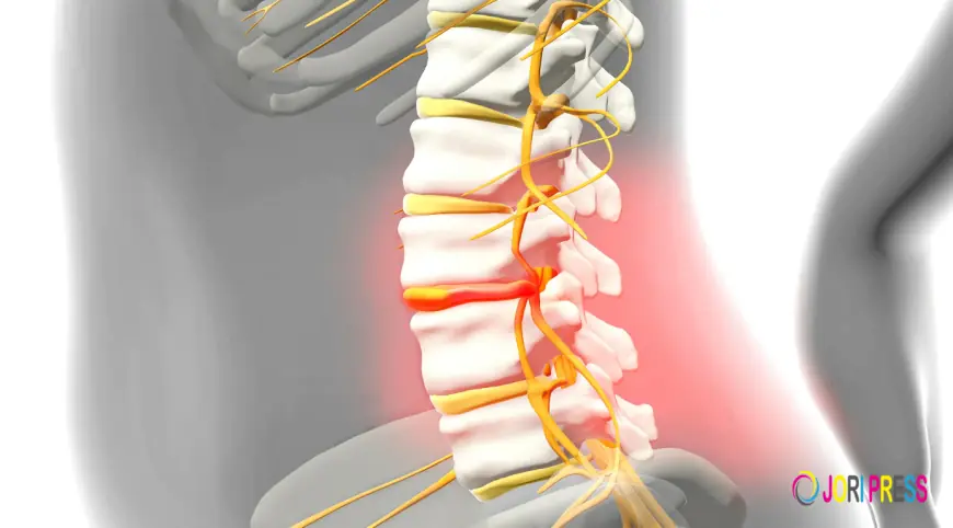 What is Herniated Disc? Causes & Treatments