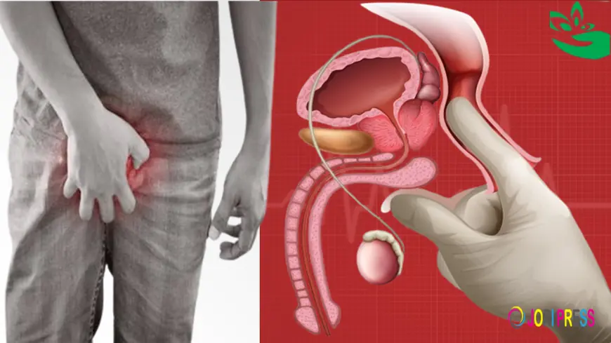 Silent Epidemic: Prostate Cancer Rates Skyrocket Across Uganda