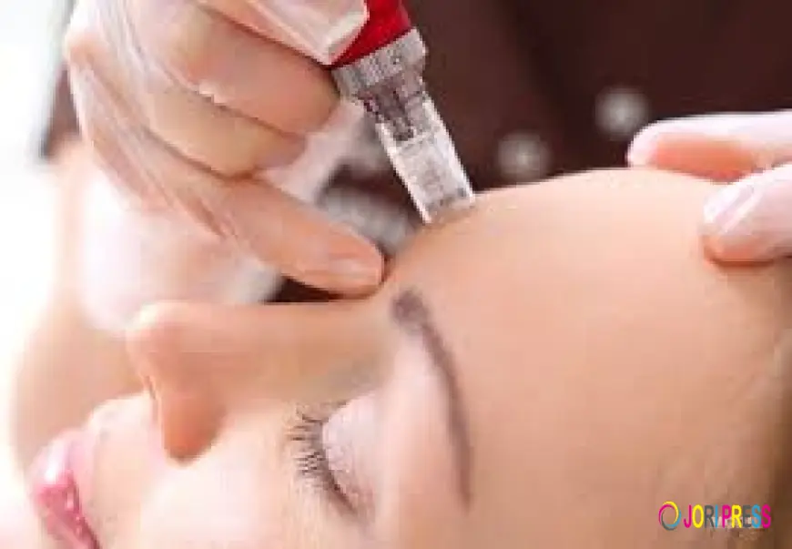 How Laser Treatment Fits into a Full Rosacea Management Plan