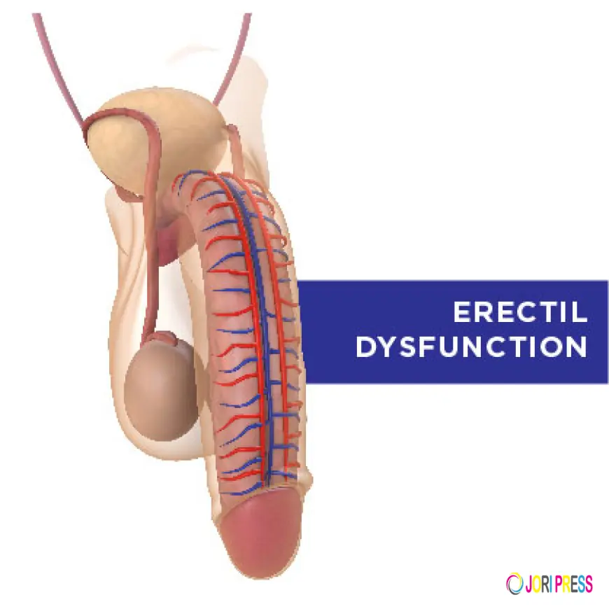 Erectile Dysfunction Surge Among Ugandan Men: Causes and Solutions