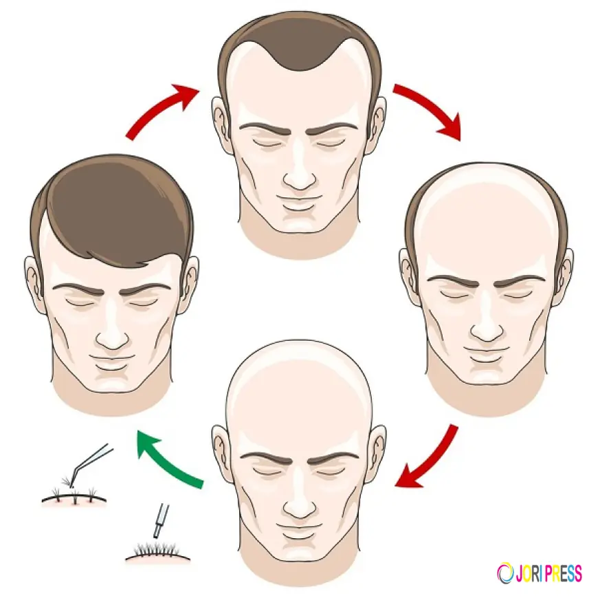 Want Hair Expands as the Leading Clinic for Hair Loss in the UK