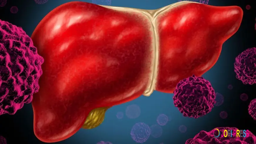 Understanding Immunotherapy for Bone Cancer: A Comprehensive Guide