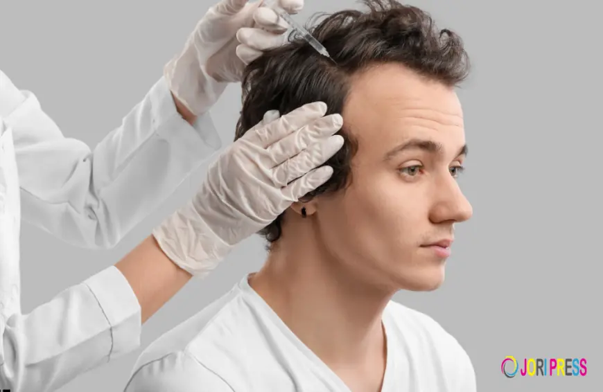 Hair Transplant in Delhi – Everything You Need to Know