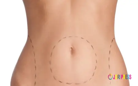 أفضل عيادات شد البطن في الرياض: دليلك لاختيار المكان المثالي