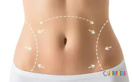 Reclaim Your Confidence with a Stomach Tightening Treatment in Riyadh