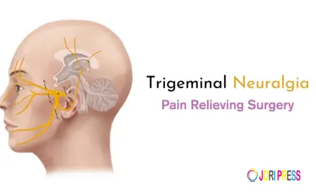 Trusted Neurology Care for Trigeminal Neuralgia & Nerve Pain