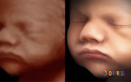 3D or 4D Ultrasound — Which One Should You Choose for Your Pregnancy?