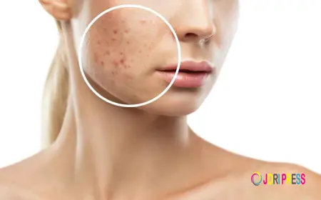 Understanding How Laser Treatments Help Reduce Scars Safely and Effectively