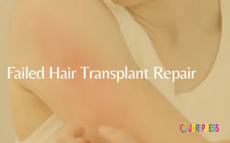 Restore Your Confidence with the Best Hair Transplant Surgeon in Bareilly – AuraDermé by Dr. Megha Tandon