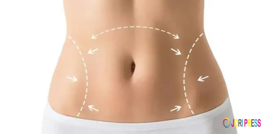 Reclaim Your Confidence with a Stomach Tightening Treatment in Riyadh