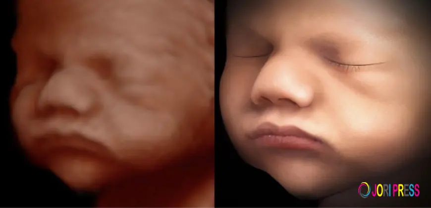 3D or 4D Ultrasound — Which One Should You Choose for Your Pregnancy?
