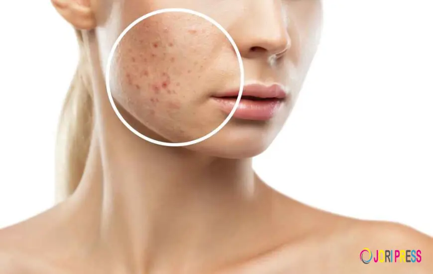 Understanding How Laser Treatments Help Reduce Scars Safely and Effectively