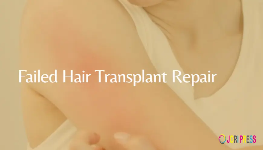 Restore Your Confidence with the Best Hair Transplant Surgeon in Bareilly – AuraDermé by Dr. Megha Tandon