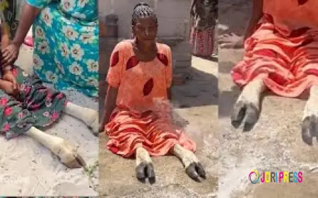 Busia Woman Who Stole Another’s Husband Suffers Bizarre Curse, Legs Transform Into Cow-Like Limbs