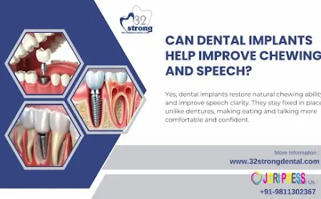 Teeth Implant in Delhi – A Permanent Solution for a Confident Smile