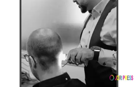 New Confidence Awaits: Want Hair Ltd Introduces Advanced Hair Transplant Solutions