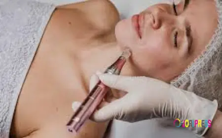 Rosacea Relief During the Festive Season: Brighten Your Skin with Advanced Laser Treatments