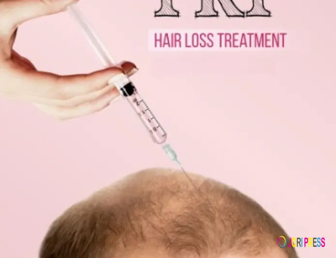 Restore Thicker Hair with PRP Treatment in Islamabad