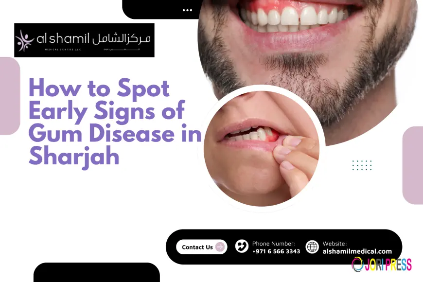 How to Spot Early Signs of Gum Disease in Sharjah