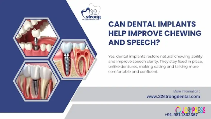 Teeth Implant in Delhi – A Permanent Solution for a Confident Smile