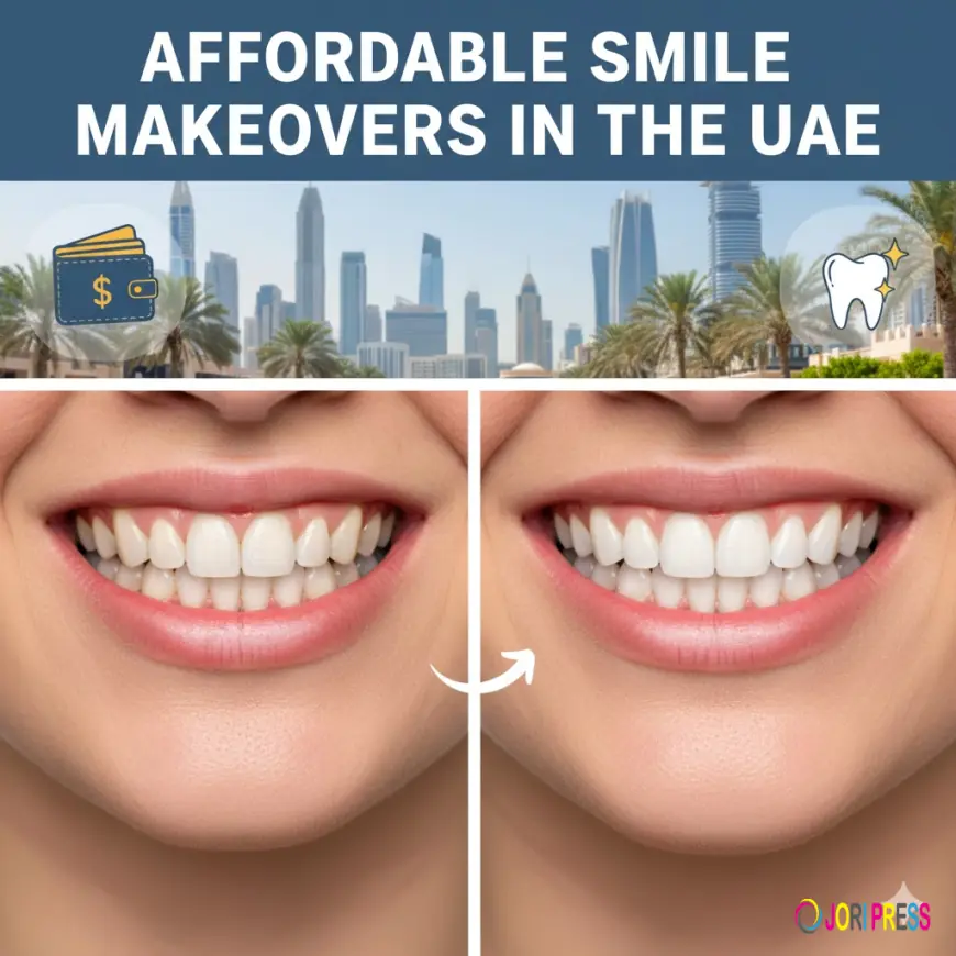 Affordable Smile Makeovers in the UAE: What to Expect