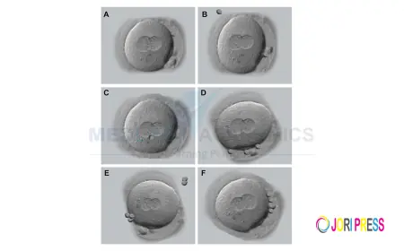 Embryo grading and its importance: Embryology Training in India