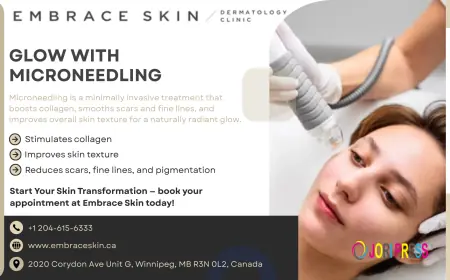 Embrace Skin Clinic Expands Advanced Micro Needling Services in Winnipeg