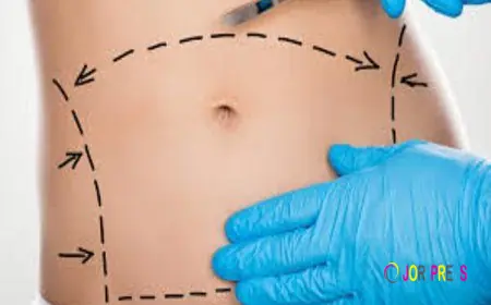 Can Tummy Tuck Surgery Improve Abdominal Muscle Tone?
