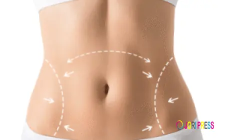 Liposuction in Dubai: Achieve Your Ideal Body Shape