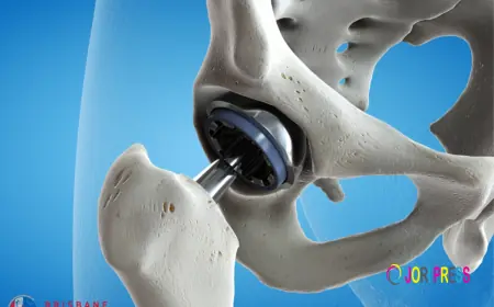 Expert Hip Specialists and Modern Treatment Options