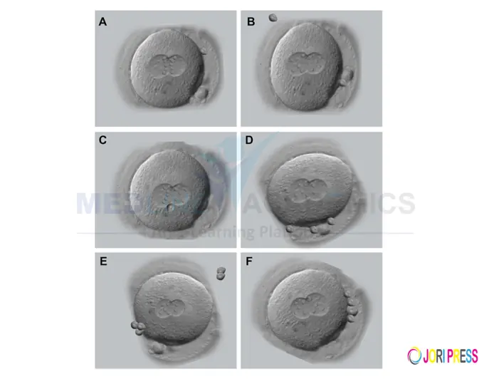 Embryo grading and its importance: Embryology Training in India