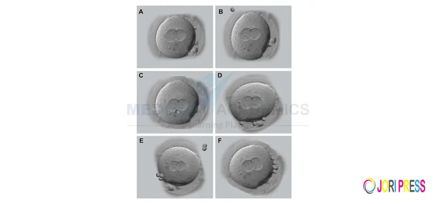 Embryo grading and its importance: Embryology Training in India