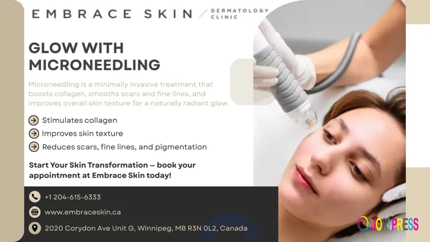 Embrace Skin Clinic Expands Advanced Micro Needling Services in Winnipeg