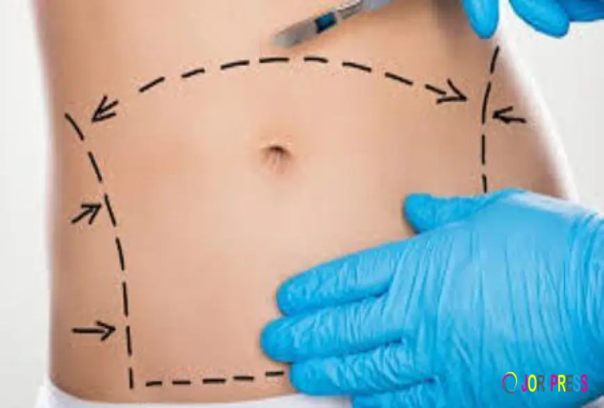 Can Tummy Tuck Surgery Improve Abdominal Muscle Tone?