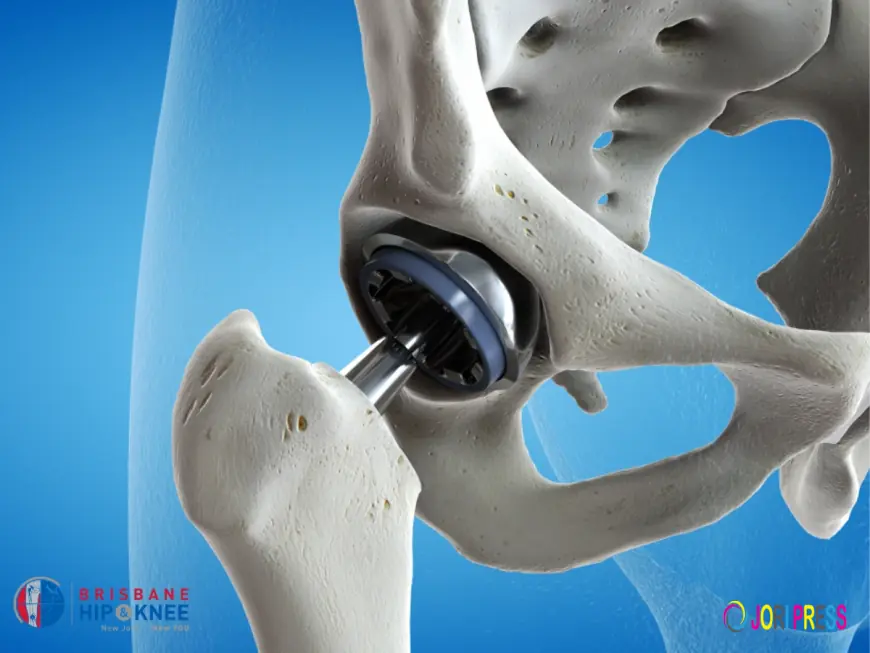 Expert Hip Specialists and Modern Treatment Options