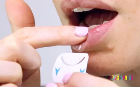 Cold Sore Patches: How They Work and Why They Help