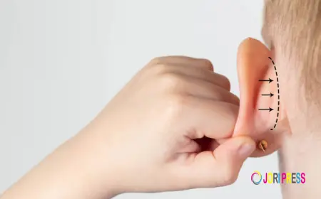 Otoplasty Recovery Timeline: What to Expect After Ear Surgery in Dubai