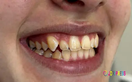 Top Signs You Need Orthodontic Treatment