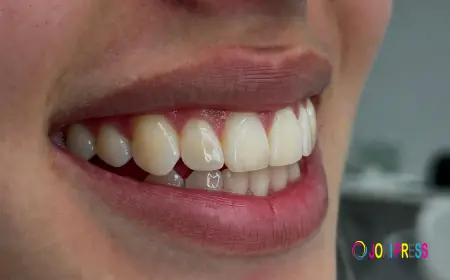 How Orthodontics Improves Smile Aesthetics