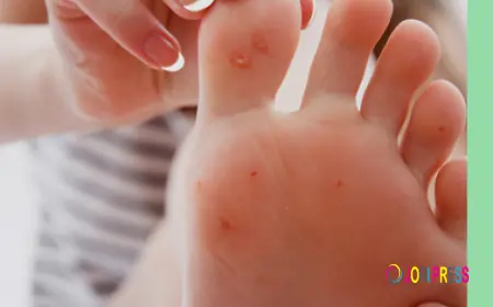 Best Ingrown Wart Removal In South Amboy at a Very Affordable Price