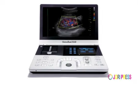 Understanding Colour Doppler Ultrasound Price: Factors, Benefits, and Value in Modern Diagnostics