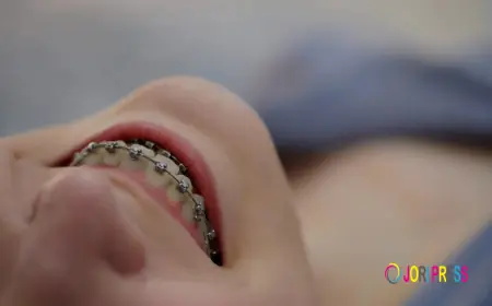 Invisalign Houston TX vs. Kids Braces Houston: Which Is Right?