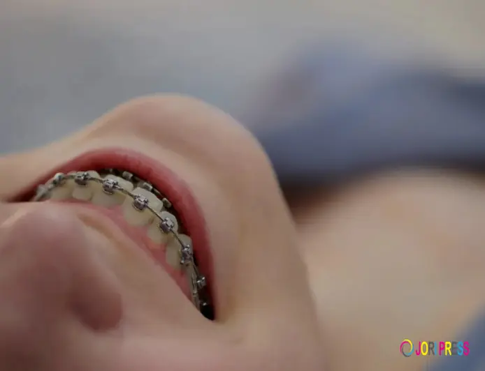 Invisalign Houston TX vs. Kids Braces Houston: Which Is Right?