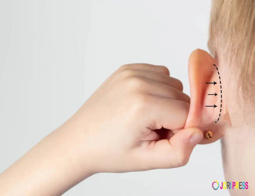 Otoplasty Recovery Timeline: What to Expect After Ear Surgery in Dubai