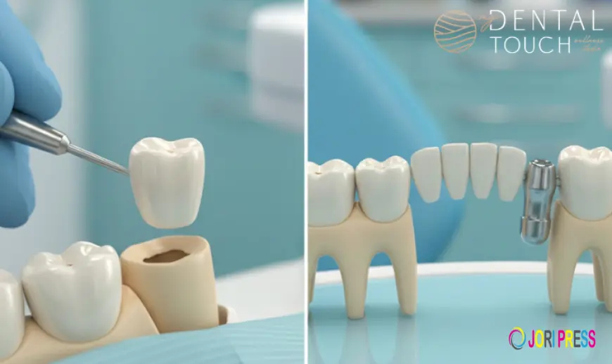 Crowns vs. Bridges: Which Dental Restoration Is Right for You?