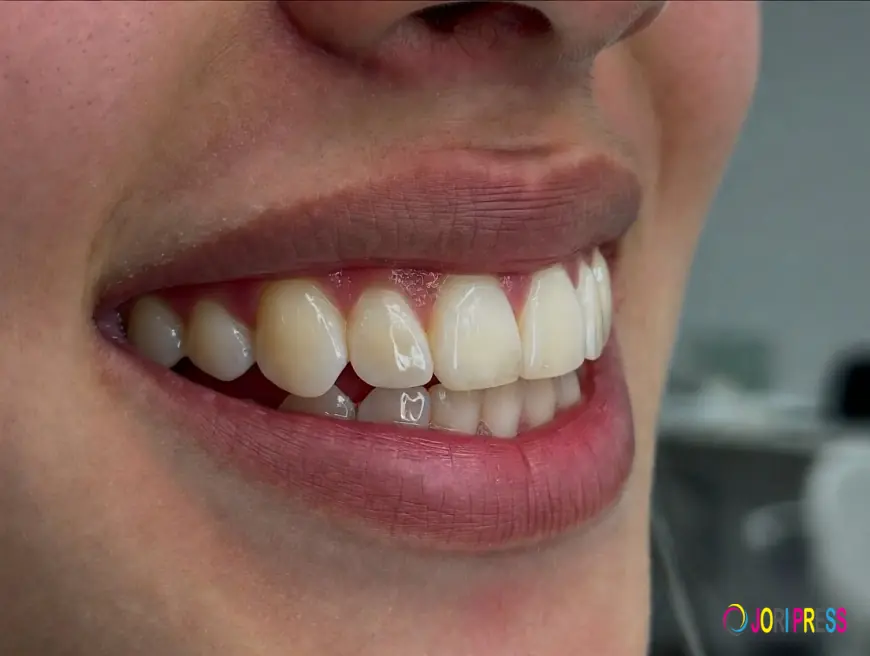 How Orthodontics Improves Smile Aesthetics
