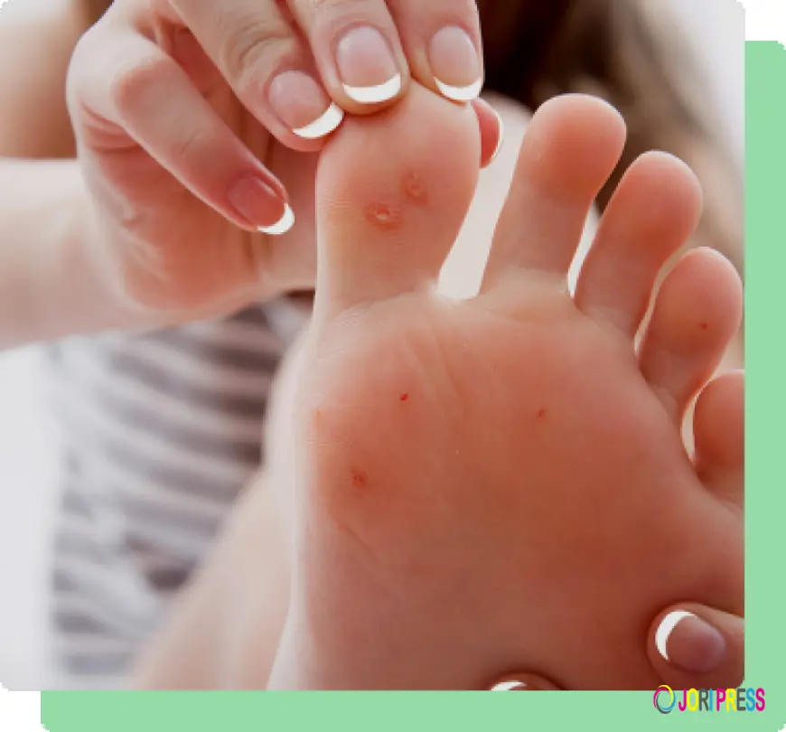 Best Ingrown Wart Removal In South Amboy at a Very Affordable Price