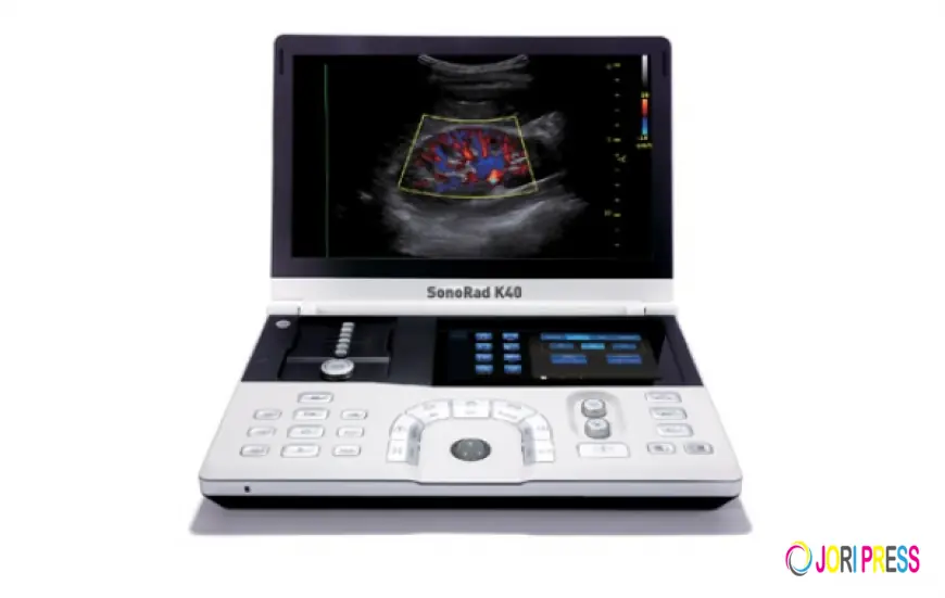 Understanding Colour Doppler Ultrasound Price: Factors, Benefits, and Value in Modern Diagnostics