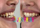 How Orthodontics Improves Smile Aesthetics